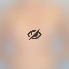 Aumento de pecho - Clínica Dr. Millán Longo y Asociados