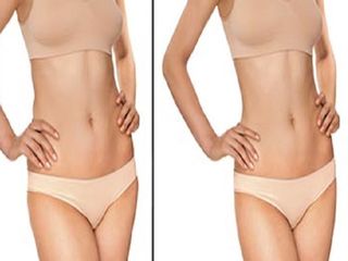 forma y linea alcazar 3