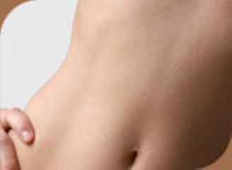 Lipoescultura