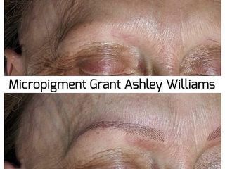 Antes y después Micropigmentación Profesional Grant Ashley Williams