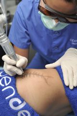 Láser QS borrado tatuajes  - Clínica Openderma