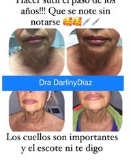 Rejuvenecimiento - Darliny Diaz Hernandez