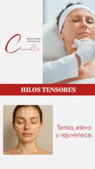 Hilos tensores - Medicina Estética Coimbra