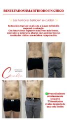Smartlipo - Medicina Estética Coimbra