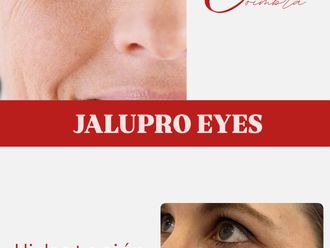 Eliminación ojeras antes y después - 876777