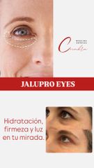 Jalupro Eyes - Medicina Estética Coimbra
