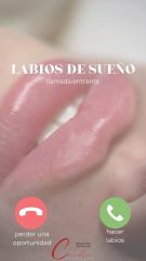 Labios - Medicina Estética Coimbra