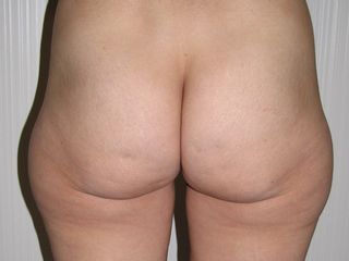 Clínica GranadoTiagonce