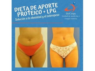 Dietas antes y después - 815724