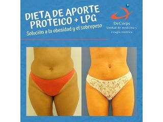 Dieta - Clínica Decorps
