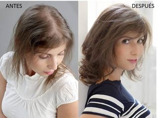 Antes y después Sistemas de integración Capilar Hair&Hair