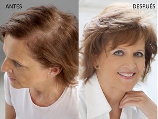 Antes y después Sistemas de cabello natural Hair & Hair 
