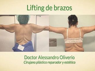 Lifting - 628895