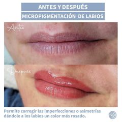 Micropigmentación - Clínica Pérez Espadero