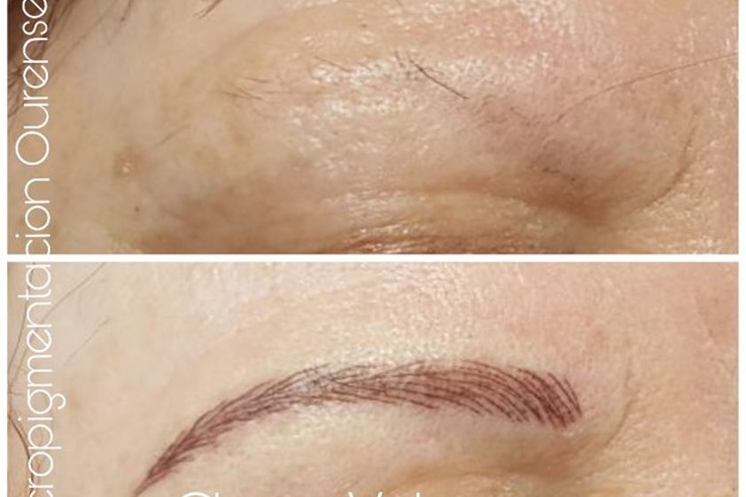Micropigmentación antes y después - 612677