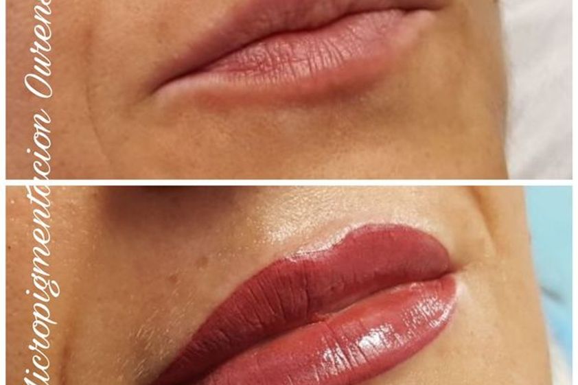 Micropigmentación antes y después - 613455