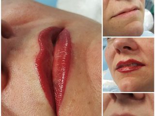 Antes y después Micropigmentacion
