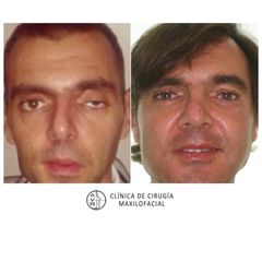 Cirugía reconstructiva - Dr. Antonio Vázquez Rodríguez