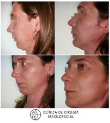 Cirugía maxilofacial - Dr. Antonio Vázquez Rodríguez