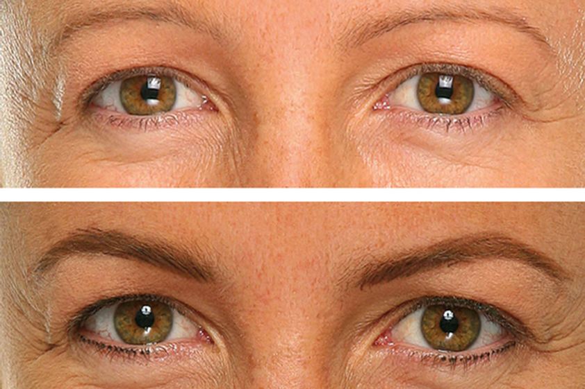 Microblading antes y después - 625133