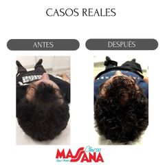 Capilar