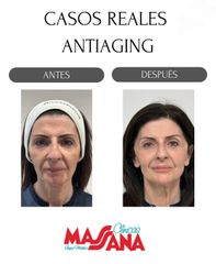Antiaging - Grupo Médico Clínicas Massana