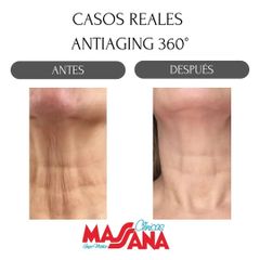 Antiaging - Grupo Médico Clínicas Massana