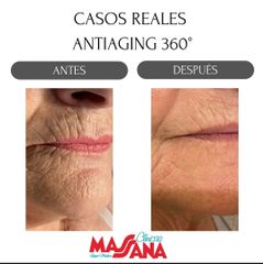Antiaging - Grupo Médico Clínicas Massana