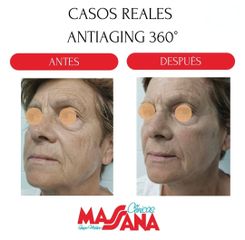 Antiaging - Grupo Médico Clínicas Massana