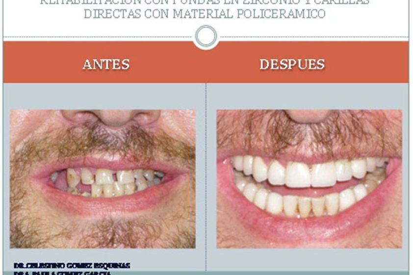 Ortodoncia antes y después - 225387