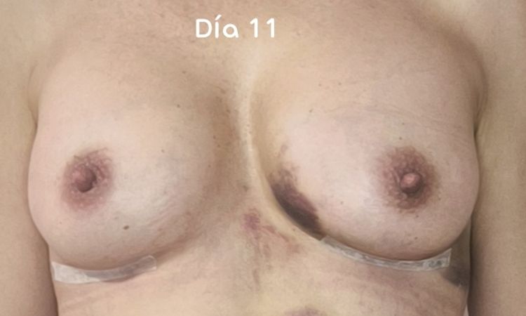 152163