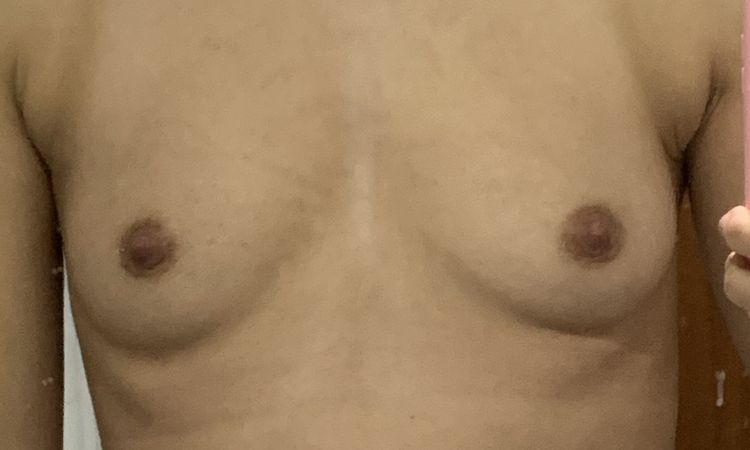 76464