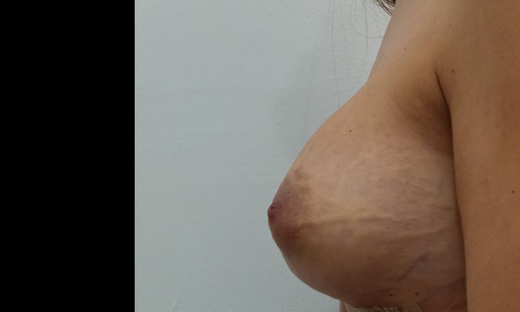129516