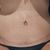 Reconstrucción de abdomen
