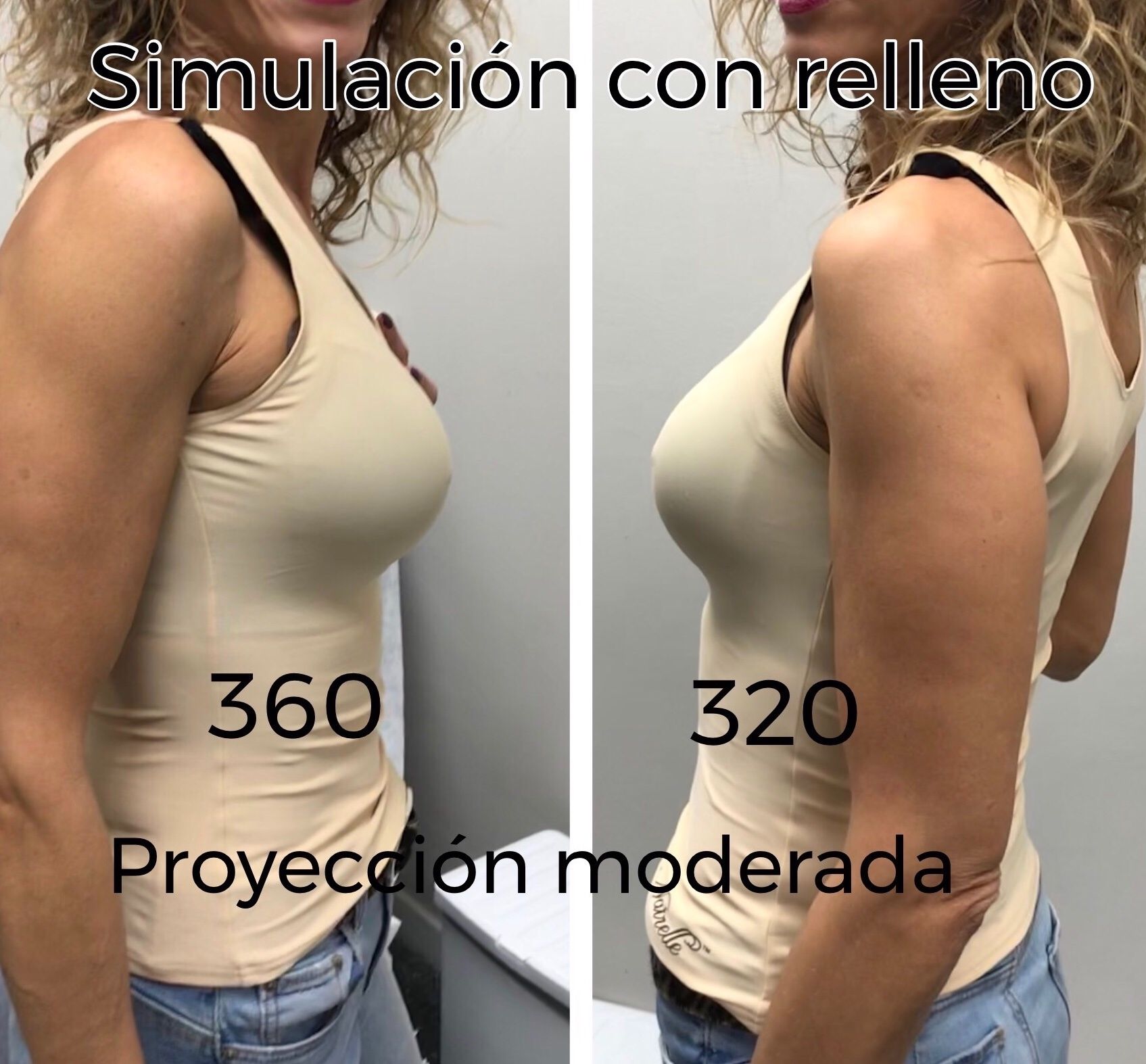 Tres meses de mi aumento Aumento de pecho Tres meses de mi aumento Aumento de pecho