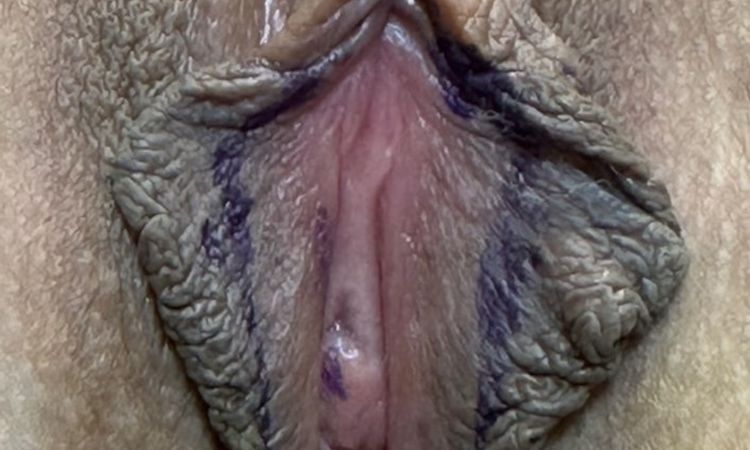 140659