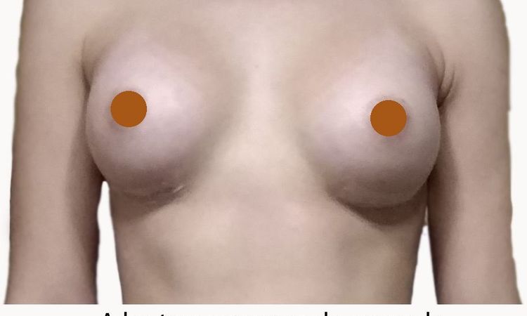 64470