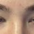 Pictures showing what Macia did to my face