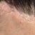 Pictures showing what Macia did to my face