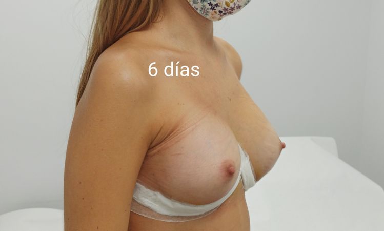 91290