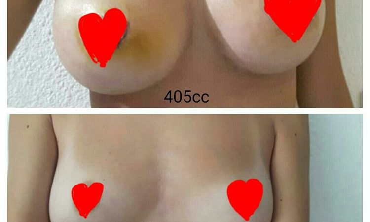 27733