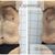 Sesiones abdominoplastia