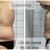 Sesiones abdominoplastia