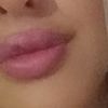 Me hice un aumento de labios en 2013, desde entonces no he podido dejar de hacerlo cuando empiezan a volver a su tamaño original. - 22496