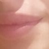 Me hice un aumento de labios en 2013, desde entonces no he podido dejar de hacerlo cuando empiezan a volver a su tamaño original. - 22497