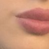Me hice un aumento de labios en 2013, desde entonces no he podido dejar de hacerlo cuando empiezan a volver a su tamaño original. - 22498