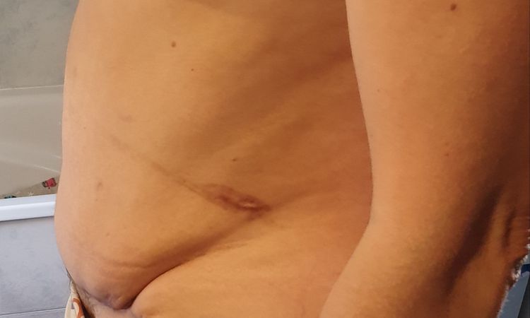 72140
