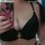 Solo dos semanas de mi abdominoplastia Turquía