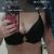 Solo dos semanas de mi abdominoplastia Turquía