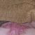 Abdominoplastia con lipoescultura